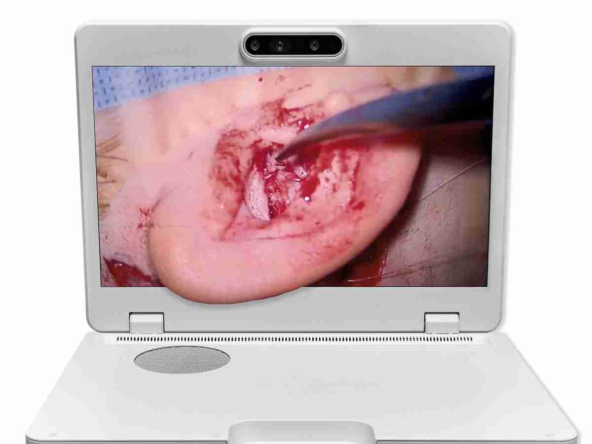 达擎之＂Heads-up 3D显微手术显示系统＂，，，整合4K裸眼3D显示及眼球追踪系统，，，具备快速追踪人眼移动位置功能，，，，减轻医师长时间维持固定姿势的负担，，让医师能有更宽广清晰的3D立体视野及更舒适的姿势来执行手术。。。